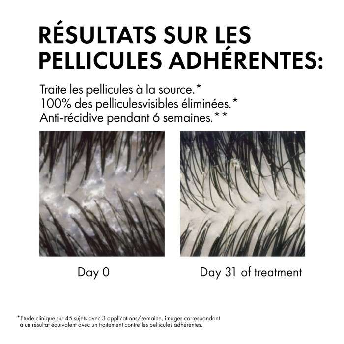 VICHY DERCOS SHAMPOING ANTI PELLICULAIRE DS CHEVEUX SECS 200 ML VICHY DERCOS SHAMPOING ANTI PELLICULAIRE DS CHEVEUX SECS 200 ML