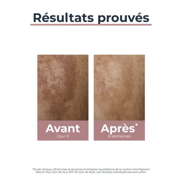 EUCERIN ANTI PIGMENT SOIN DE JOUR SPF 30 EUCERIN ANTI PIGMENT SOIN DE JOUR SPF 30