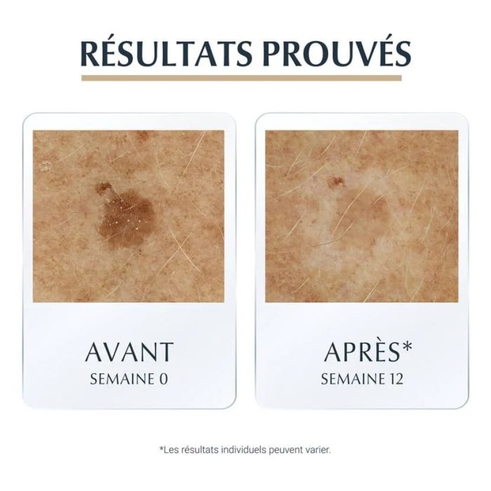 EUCERIN HYALURON FILLER + ELASTICITY SERUM 3D 30 ML EUCERIN HYALURON FILLER + ELASTICITY SERUM 3D 30 ML