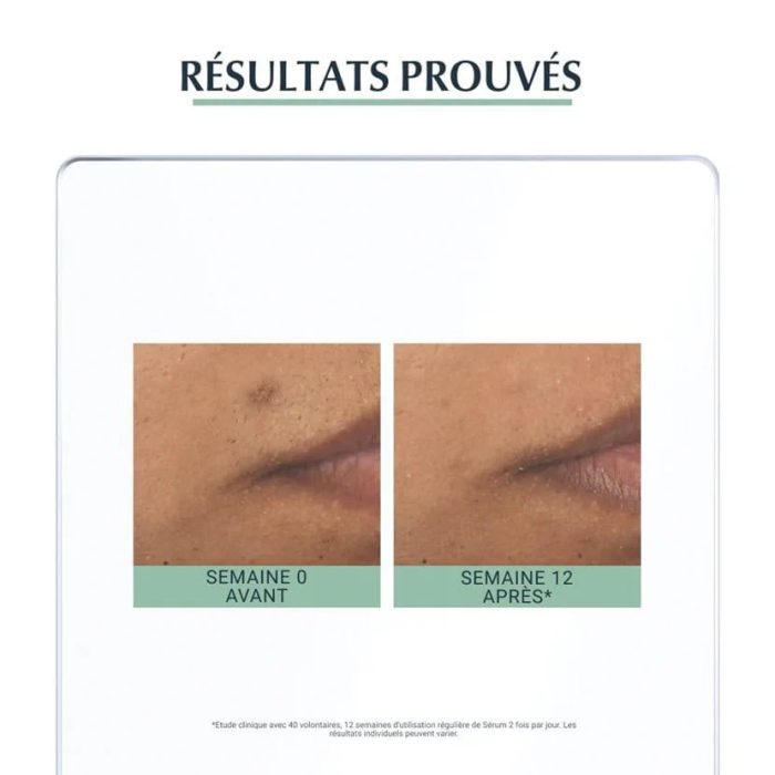 EUCERIN DERMOPURE SERUM TRIPLE ACTION 40 ML