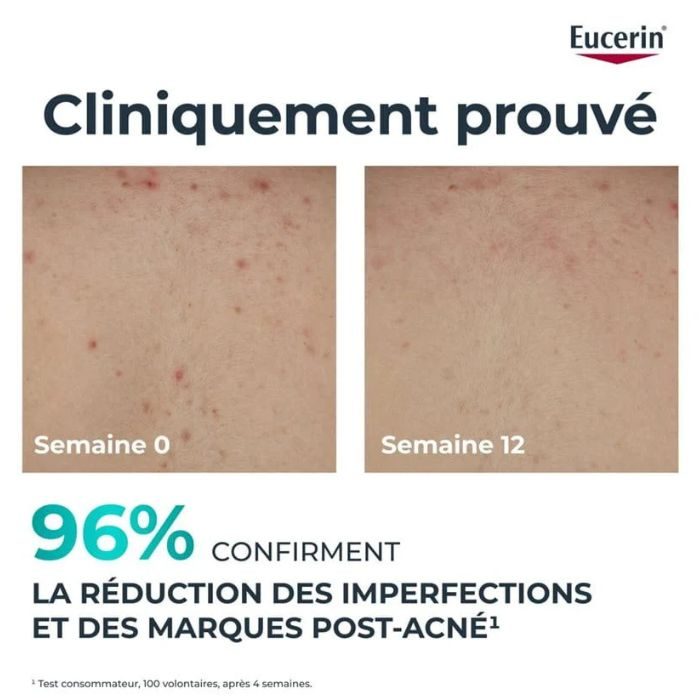 EUCERIN OFFRE 1 DERMOPURE CREME CORPS TRIPLE ACTION 200 ML ACHETE 1 OFFERT