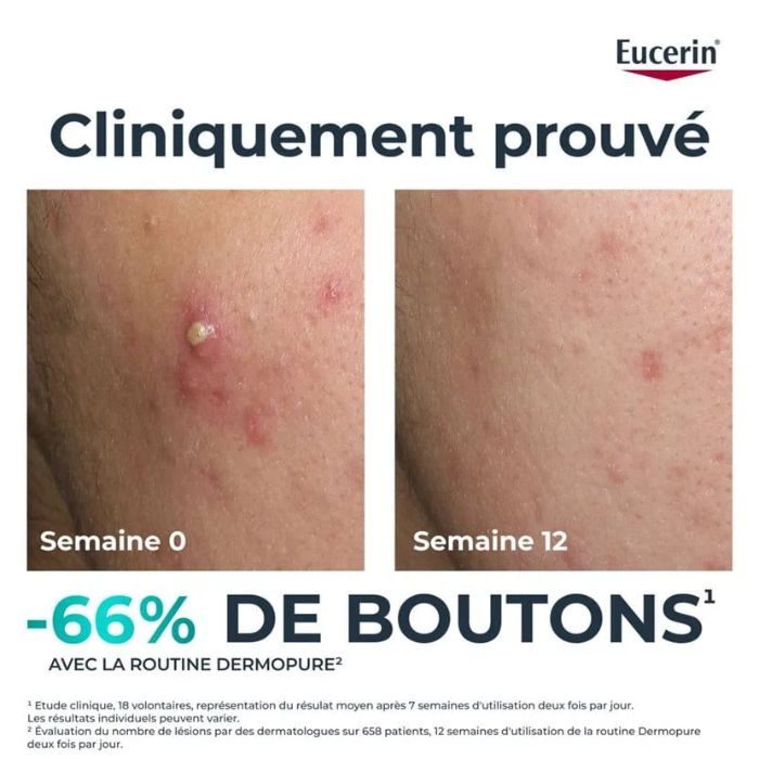 EUCERIN OFFRE DERMOPURE SERUM TRIPLE ACTION 40 ML + OIL CONTROL 50ML OFFERT
